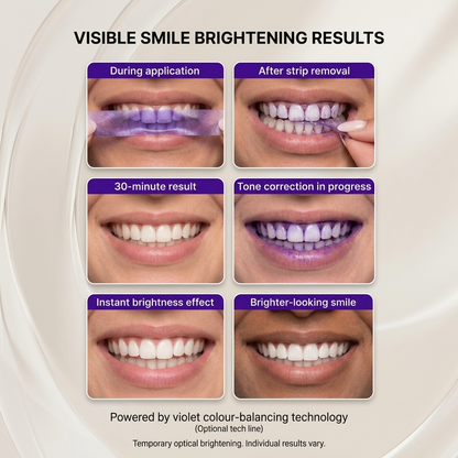 SMILEO™ - Whitening Strips