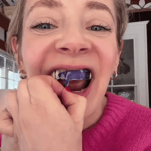 SMILEO™ - Whitening Strips