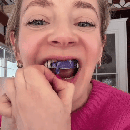 SMILEO™ - Whitening Strips